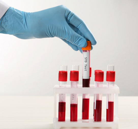 STI Testing